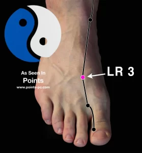 acupuncture headaches
